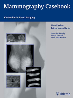 cover image of Mammography Casebook
